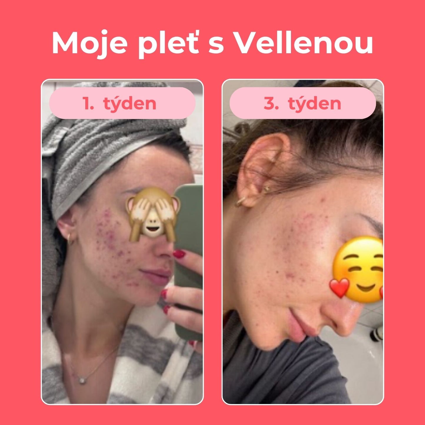 Ženské zdraví | Nápoj 2PACK | Višeň | Vellena