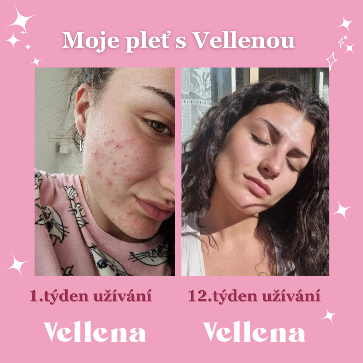 Hormonální zdraví | nápoj pro ženy 3PACK + taštička ZDARMA | Višeň