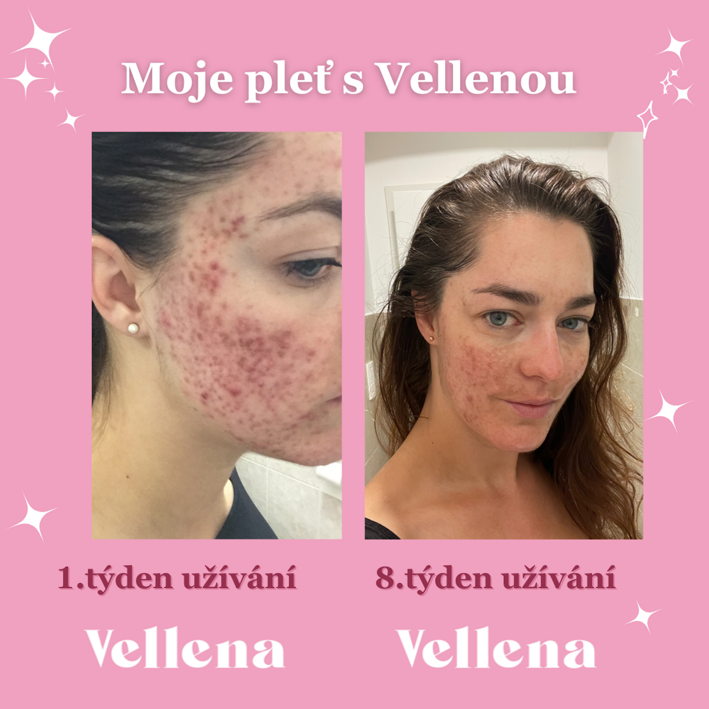Hormonální zdraví | nápoj pro ženy | Višeň