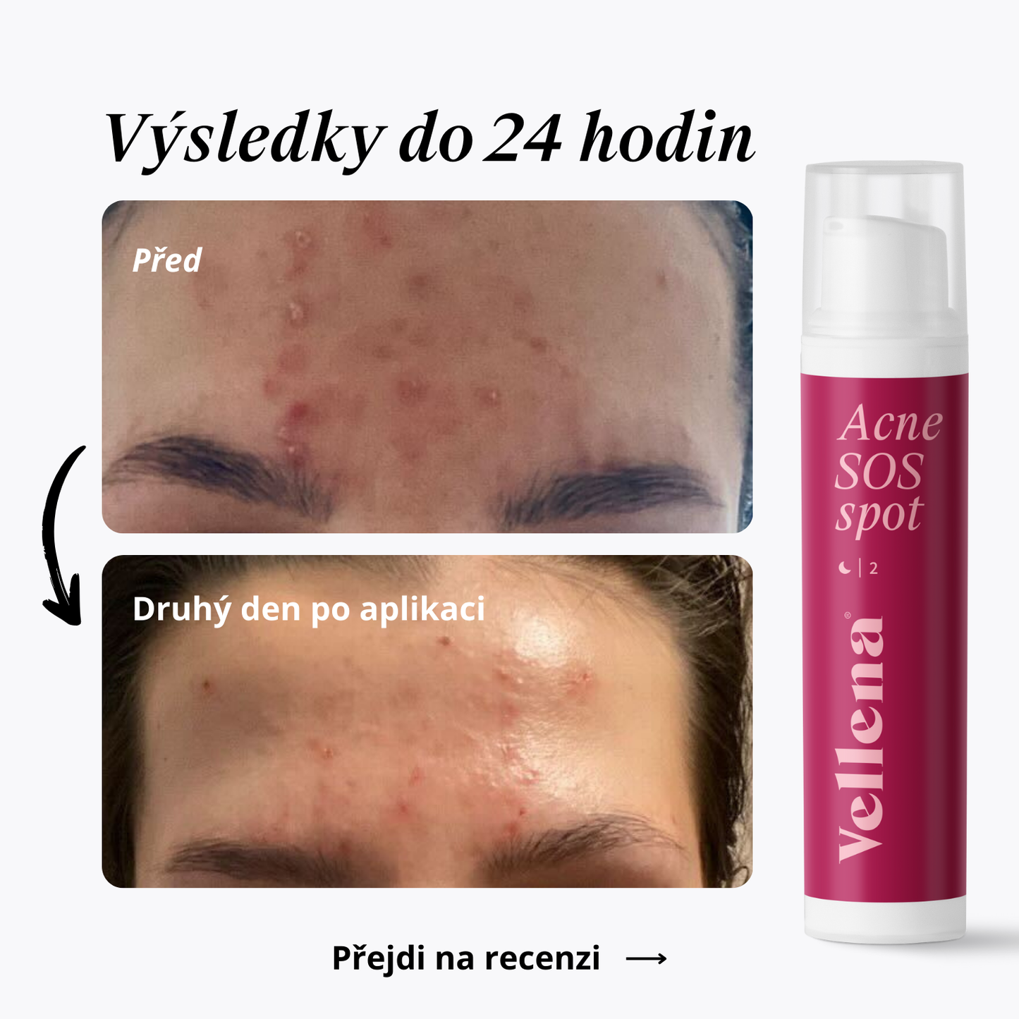 Gel na vyrážky 15ml | Vellena