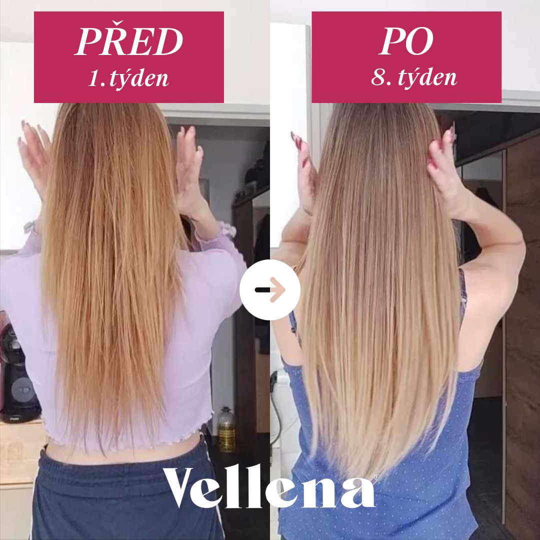 Hormonální zdraví | nápoj pro ženy 2PACK | Višeň