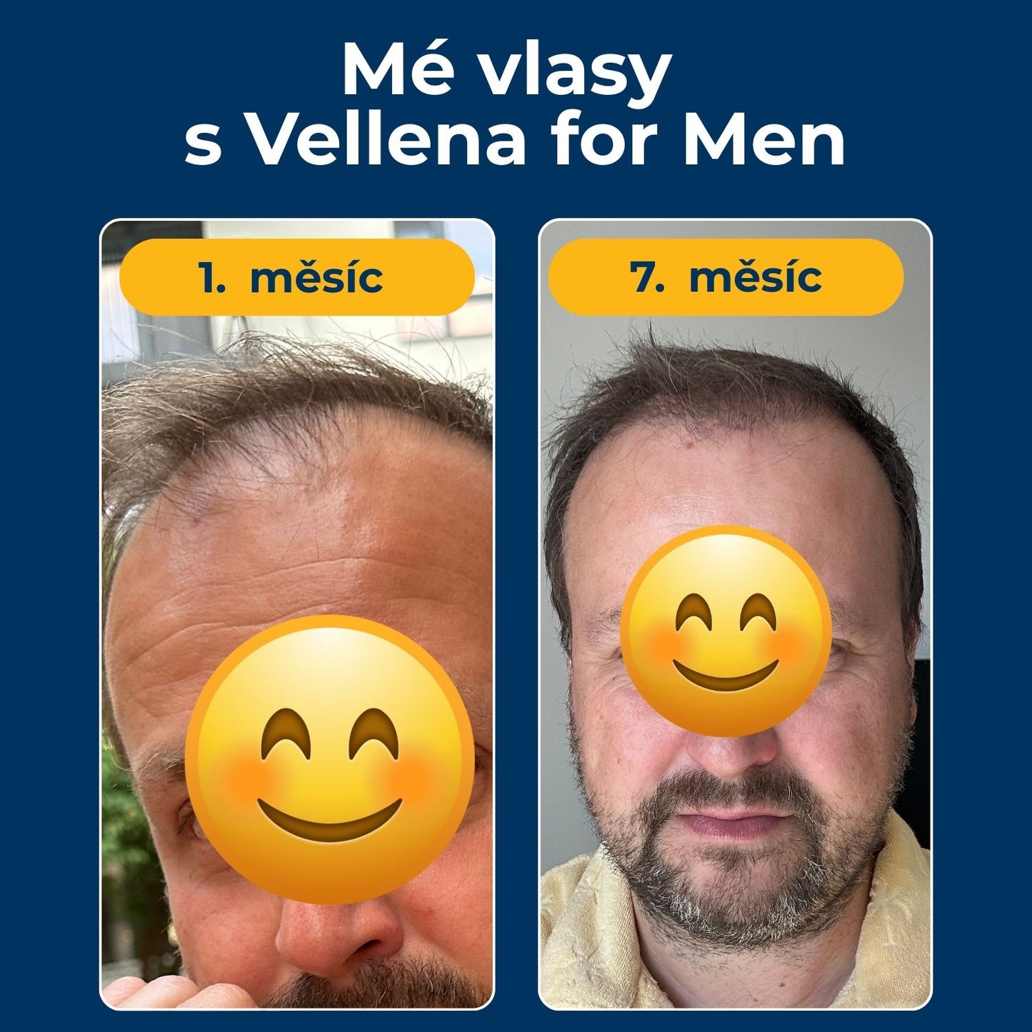 Mužské zdraví | Kapsle | Vellena for Men