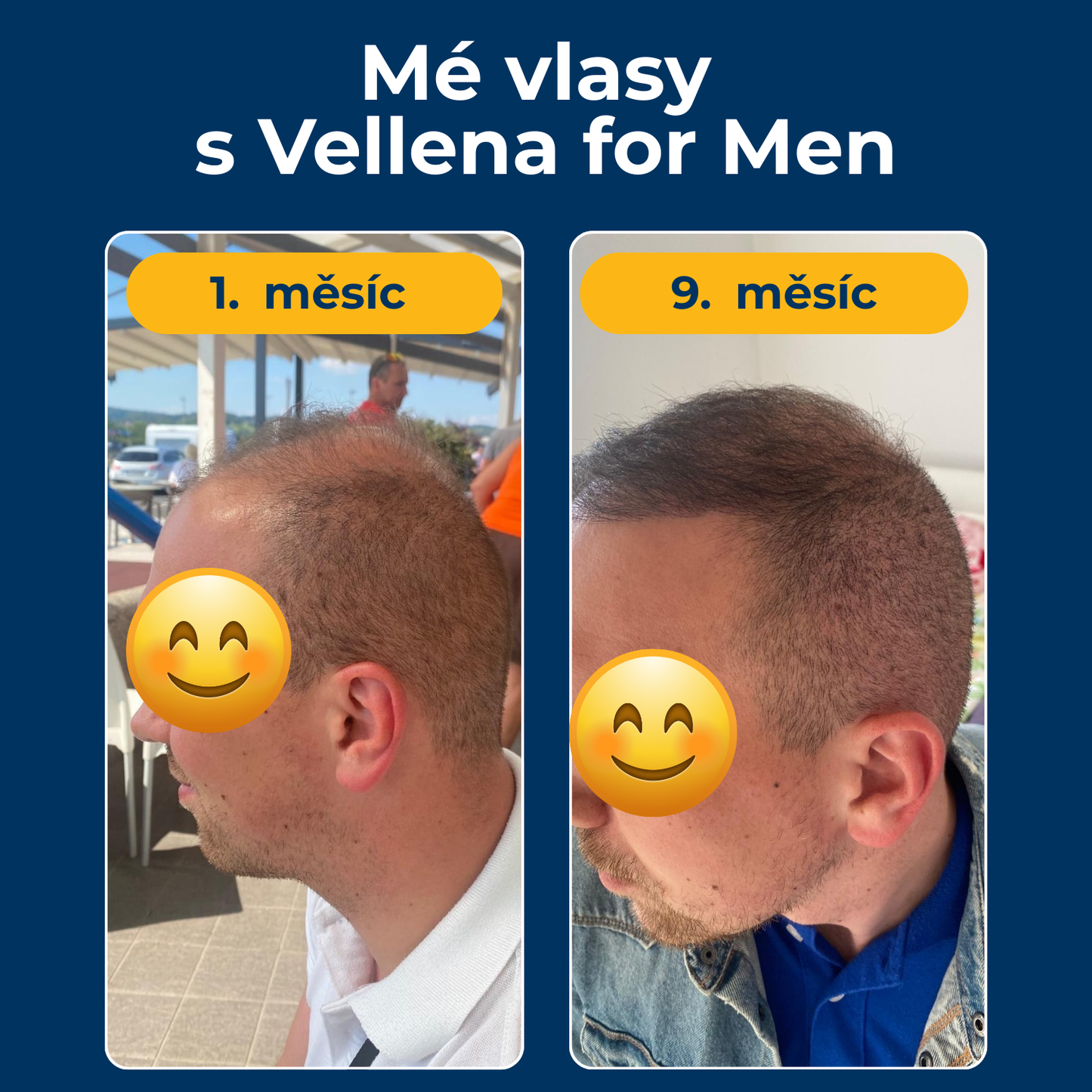 Mužské zdraví | Kapsle | Vellena for Men